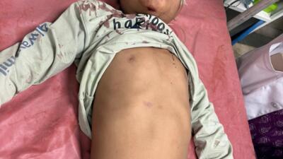 गंभीर रूप से घायल बच्चे को अस्पताल के बाहर छोड़कर हुए फरार 
